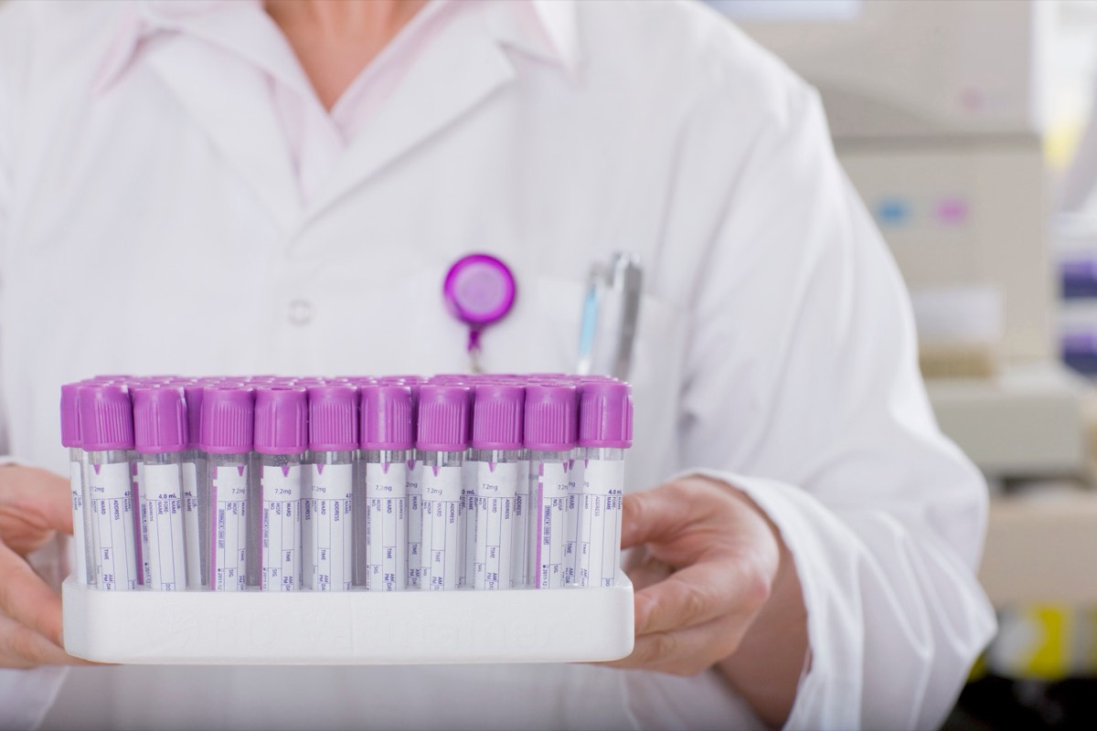 A laboratory technician analyzing a blood sample